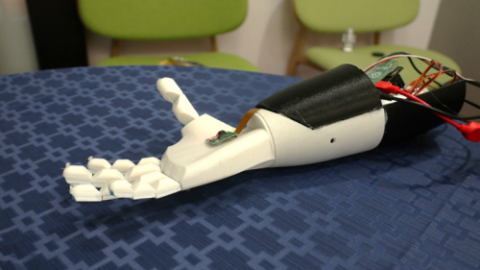 prosthetic arm